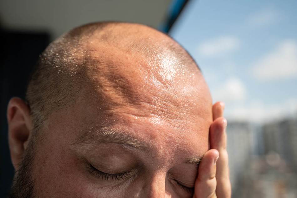 Simptomi sunčanice i toplotnog udara