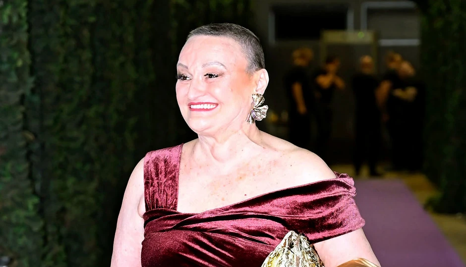 (FOTO) "ŽELJA ZA ŽIVOTOM" Milica Dugalić pokazala kako izgleda usred borbe s rakom